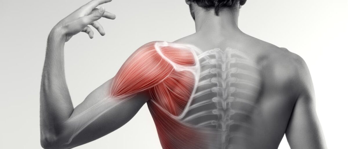 Best ways to recover from muscle strain